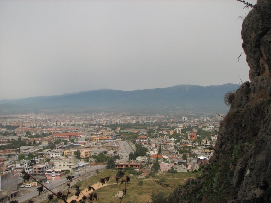 Hatay protez saç