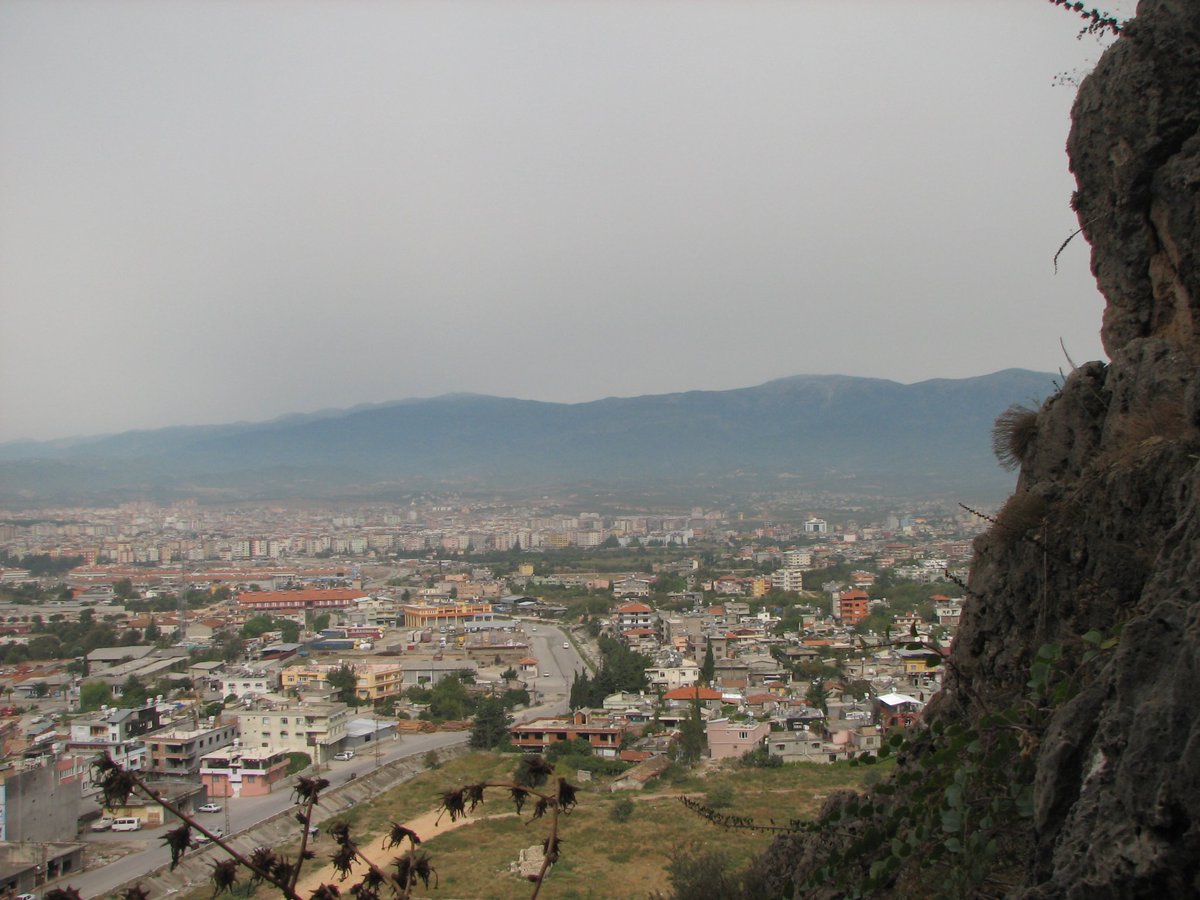 Hatay protez saç