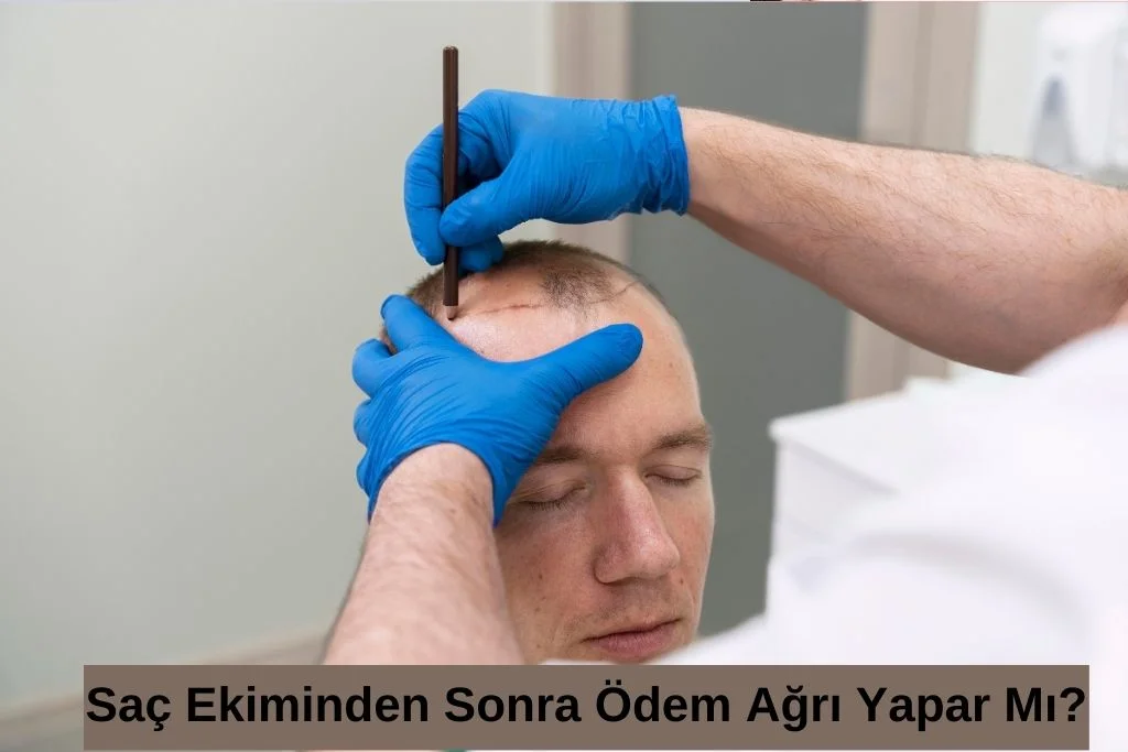 Saç Ekimi Sonrası Ağrı