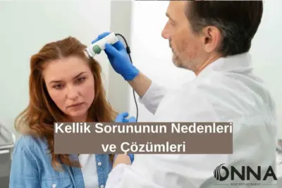 Kellik Sorununun Nedenleri