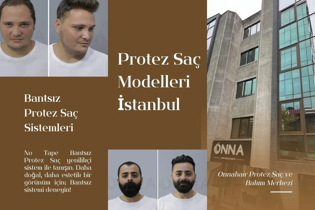 protez saç modelleri istanbul