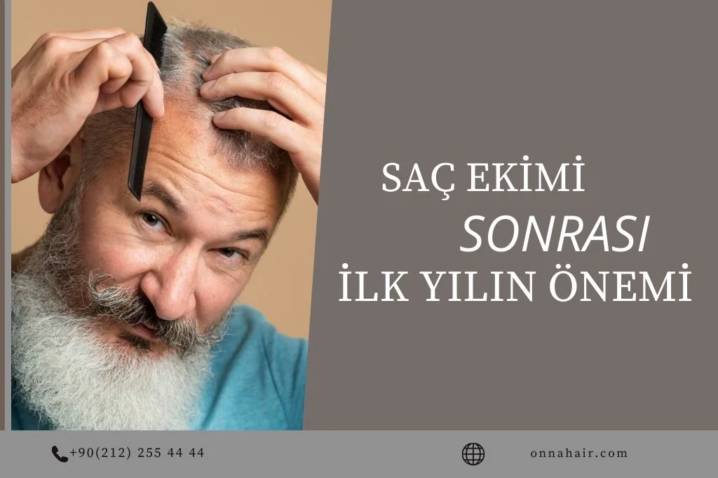 Saç Ekimi Sonrası Ilk Yıl